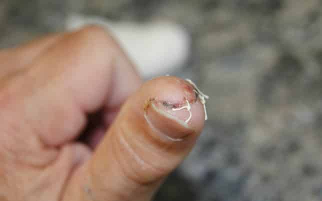 Seguro para médicos com proteção financeira para erro médico 15 Crença Soluções que Cuidam - Seguro de vida, seguro para erro profissional e seguro para erro médico como proteção financeira para imprevistos de reclamações judiciais de erro médico e erro profissional, acidentes, invalidez, doenças e fatalidades da vida. Proteções financeiras que cuidam da sua reputação profissional, do seu patrimônio, da sua renda e da sua família. A família continua, o negócio é mantido ou um legado é criado para as outras gerações por causa das nossas soluções que cuidam. Oferecemos tranquilidade em um momento de dificuldade.